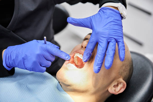 Best Lost Filling or Crown Replacement in North Myrtle Beach, SC